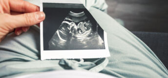 ultrasound baby pregnancy ivf fertility